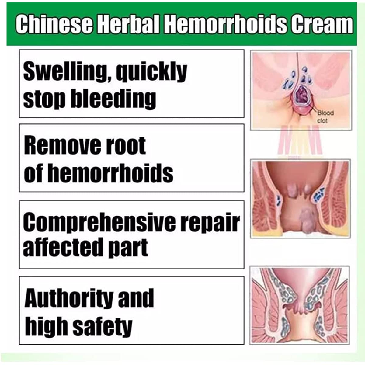 1 Box,  HuaTuo Chimese Herbal Hemorrhoids Ointment 20g/Box 痔疮膏